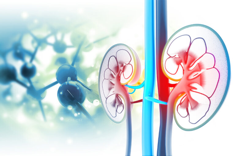 Chronic Kidney Disease And Atrial Fibrillation: A Dangerous Combination