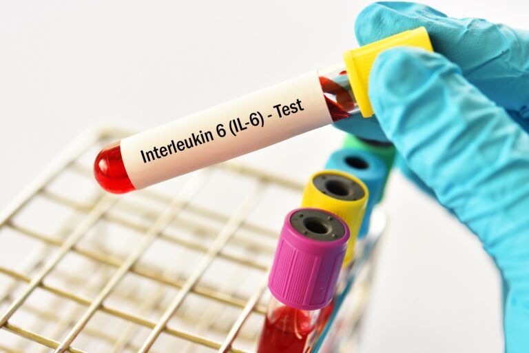 Serum Interleukin-6 Levels Predict Renal Disease Progression In Diabetic Kidney Disease